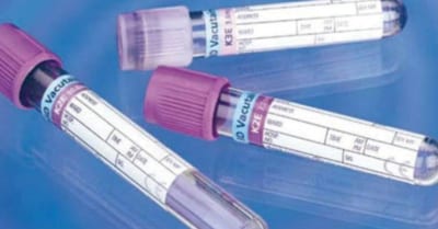 Scopri la gamma di provette  per il prelevamento del sangue sottovuoto (flebotomia) con numerosi tipi di additivi per le analisi ematologiche e di chimica clinica